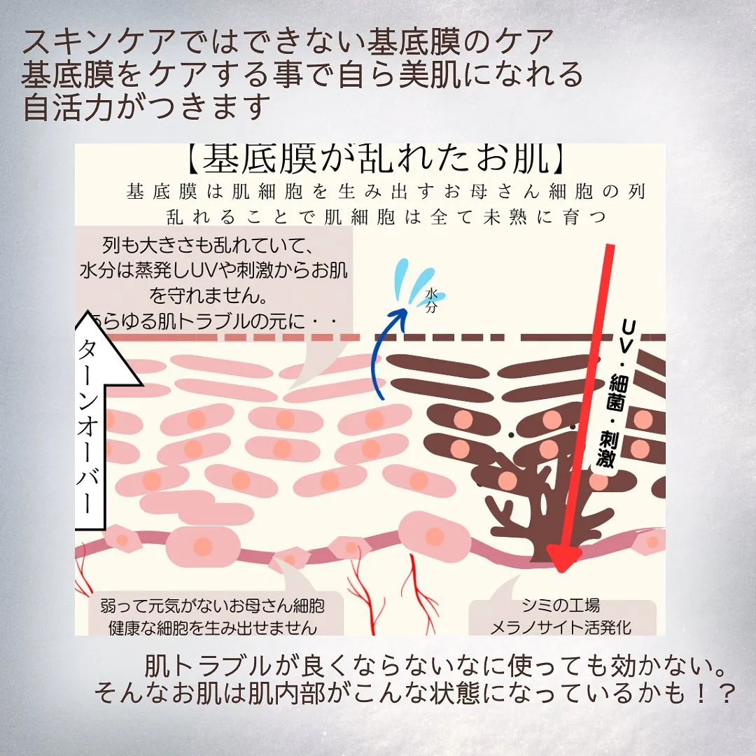 基底膜のお手入れとは