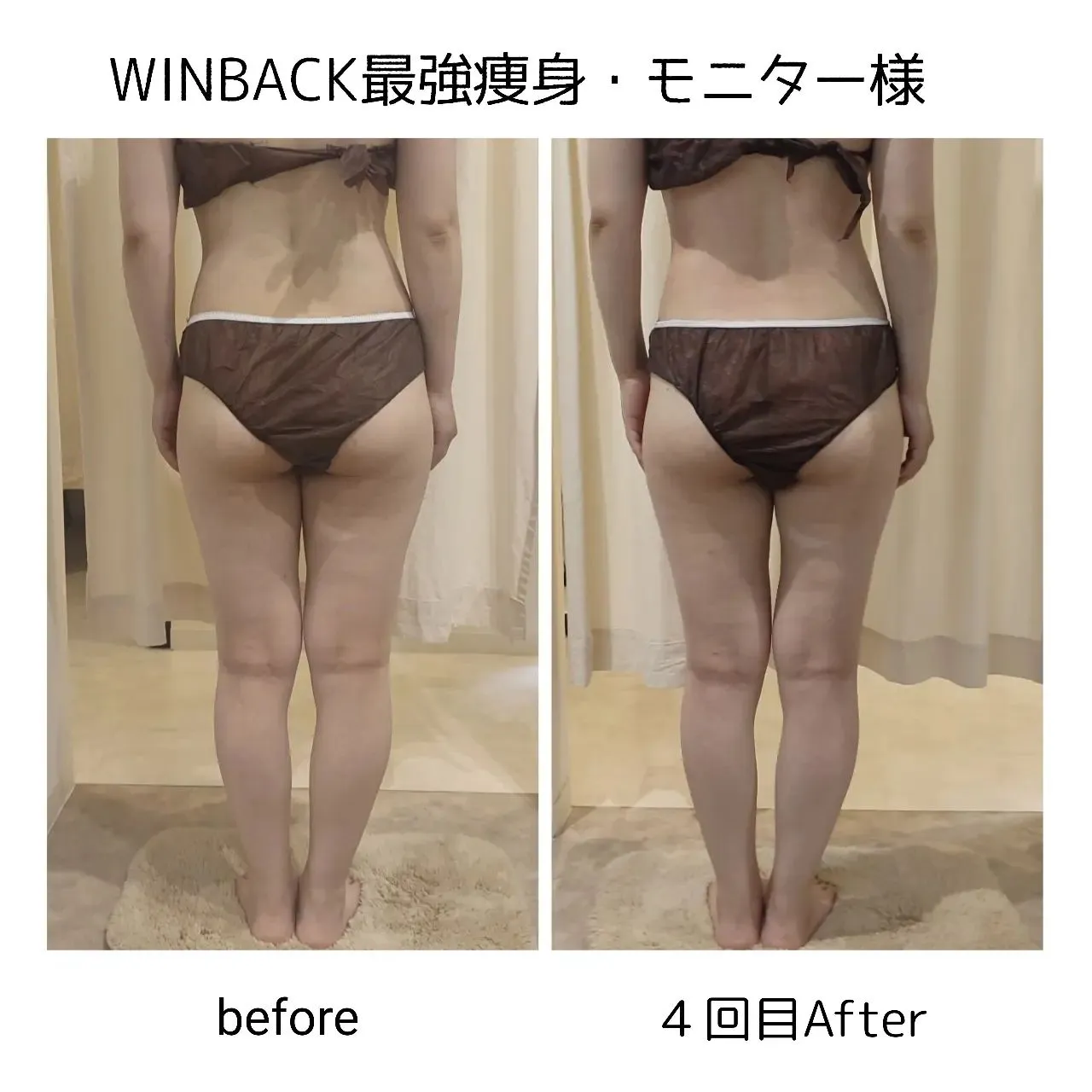 WINBACKの高周波×低周波×中周波EMSで最強痩身！