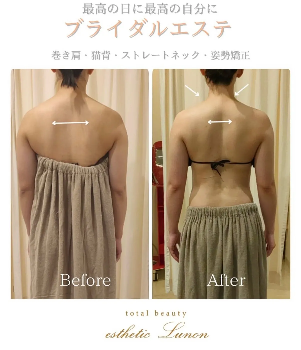 【ブライダル】フォースカッター×巻き肩猫背調整＆かみしめストレート調整
