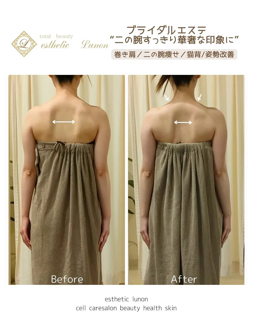 挙式に向けてブライダルエステに通われたお客様💐