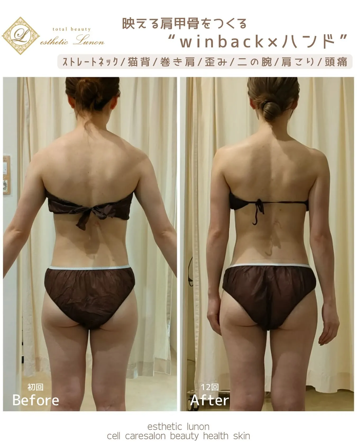 素晴らしいBefore/Afterです👏