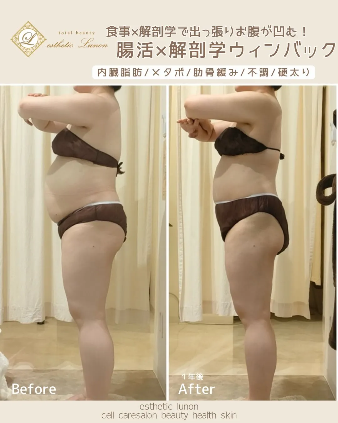 【胸下から出たお腹】