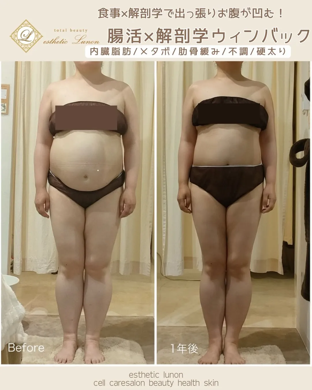 【胸下から出たお腹】