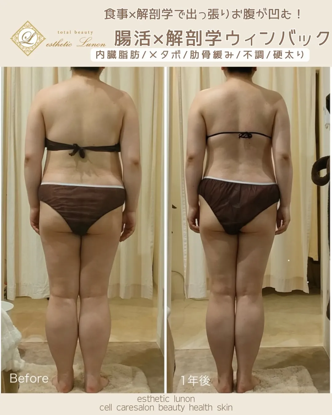 【胸下から出たお腹】