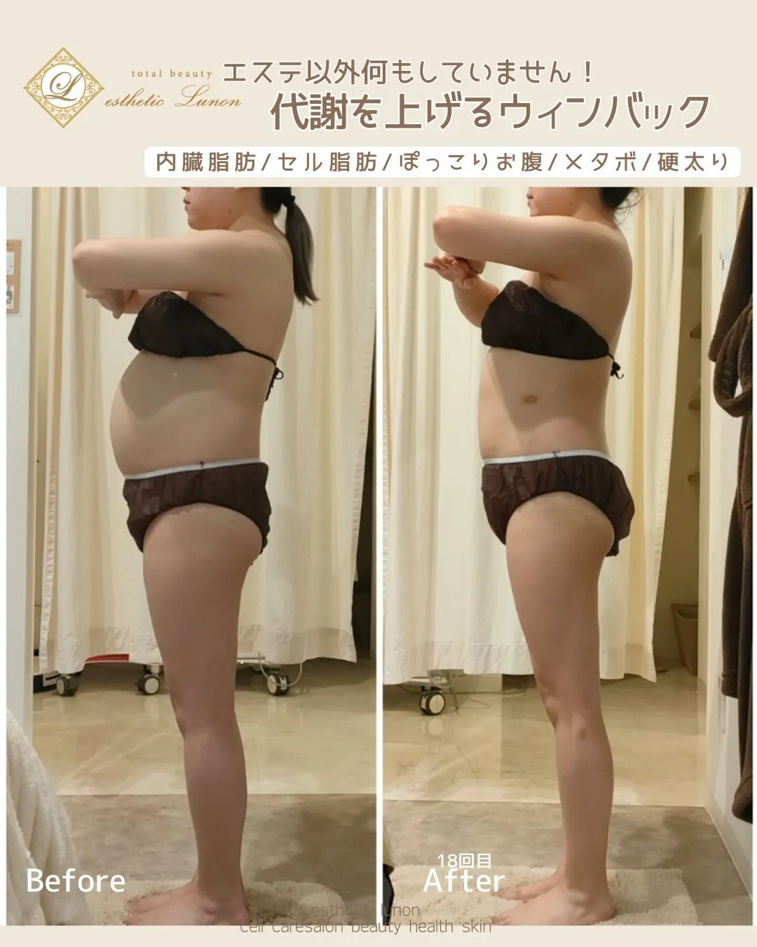 エステ以外は何もしたくない！