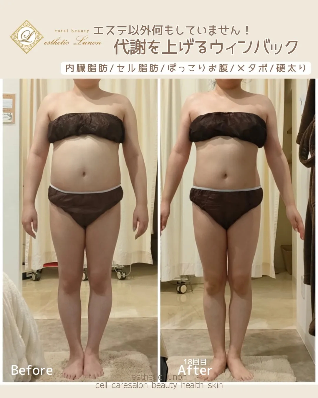 エステ以外は何もしたくない！