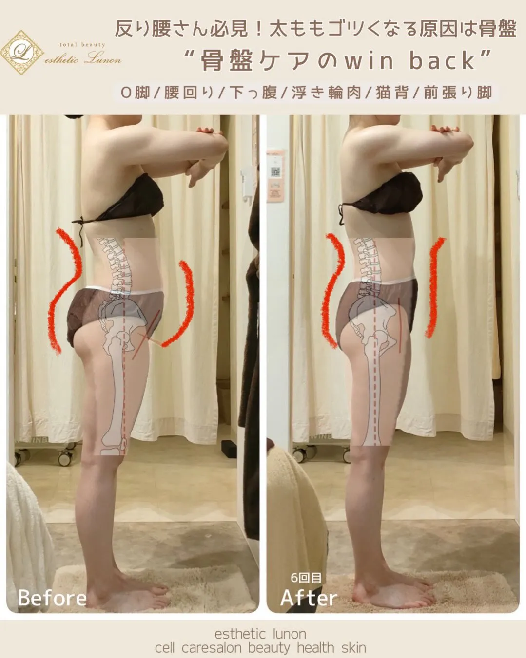 この違い、分かりますか??