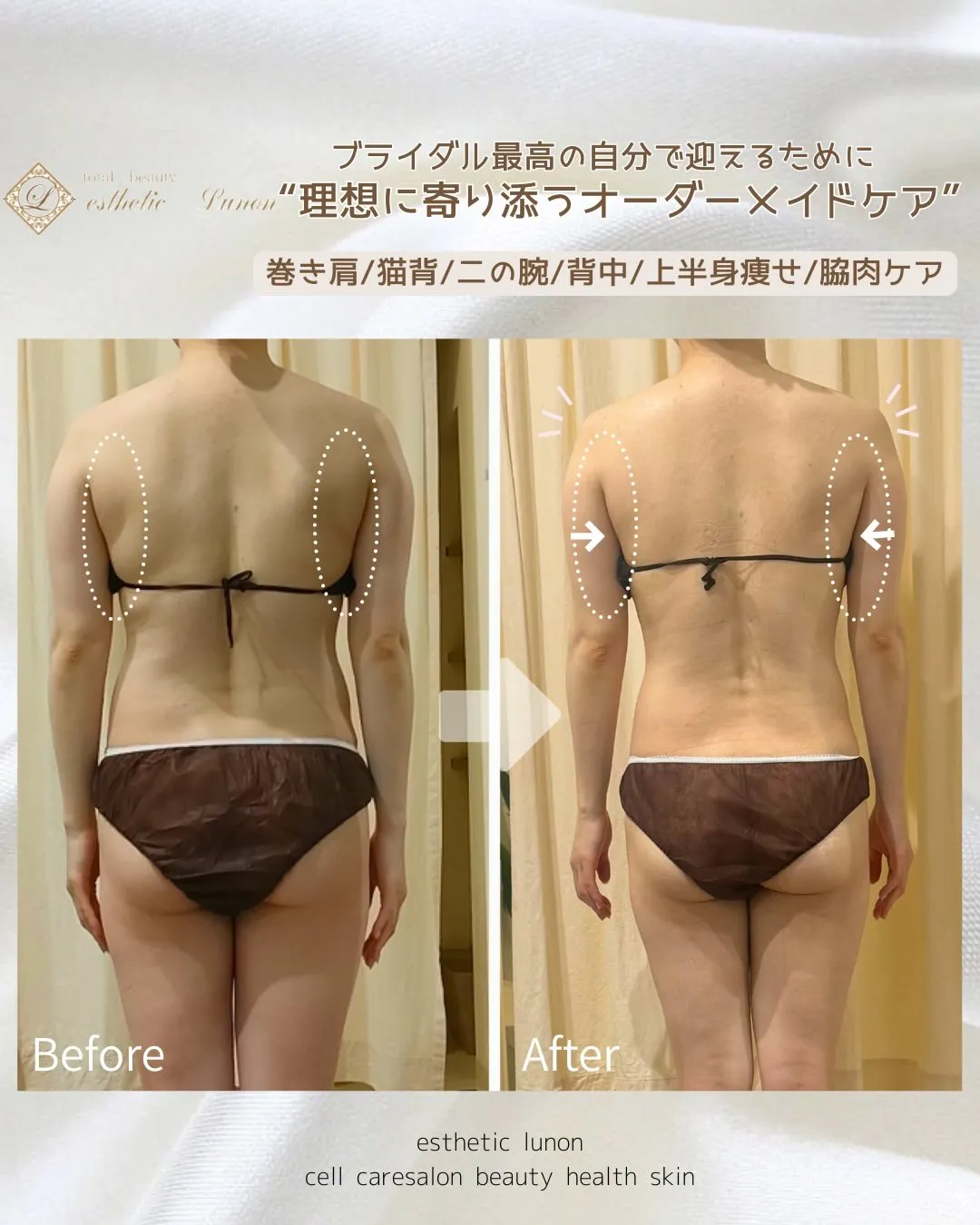 ウェディングフォトに向けて