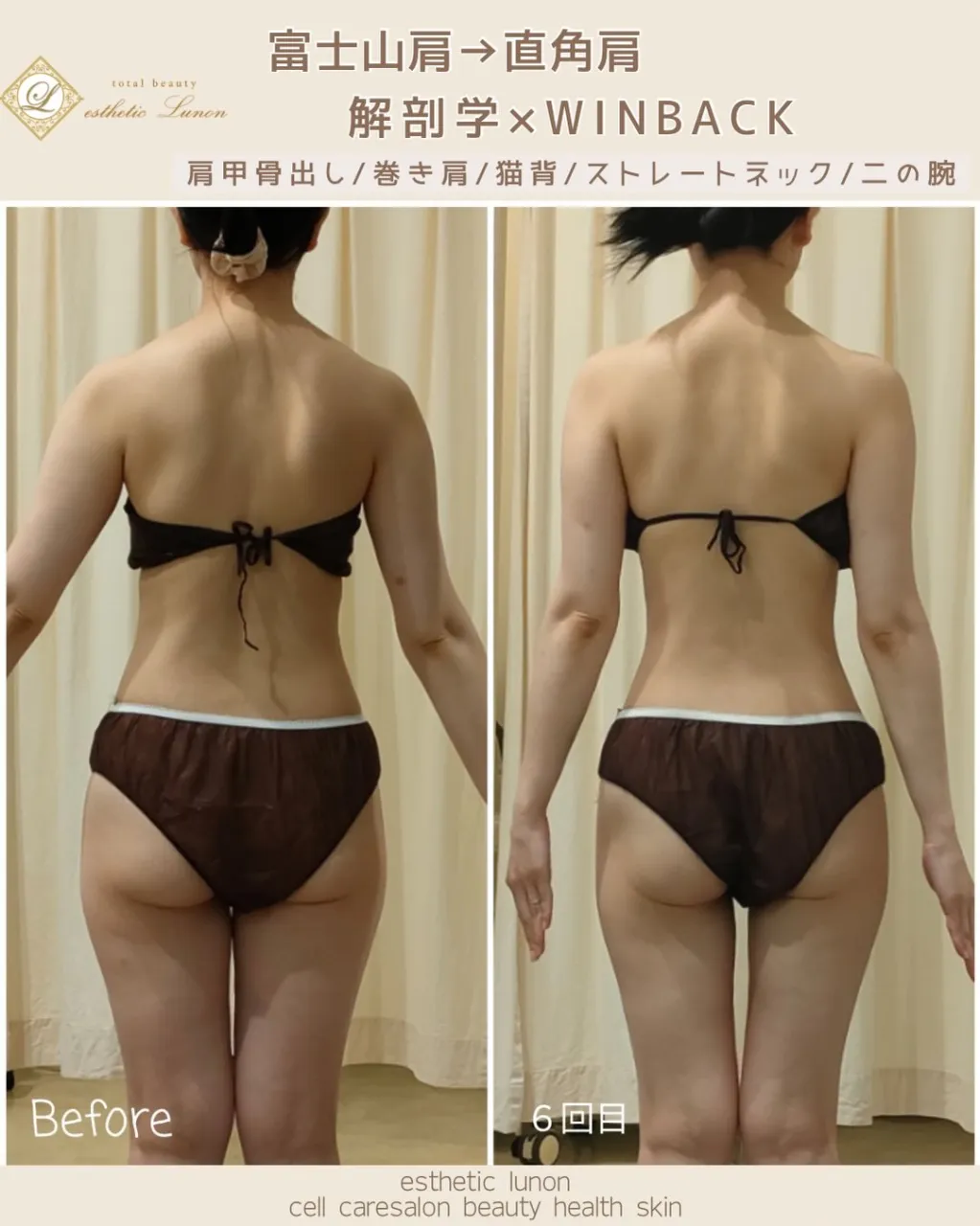ブライダルエステをご契約いただいた方の