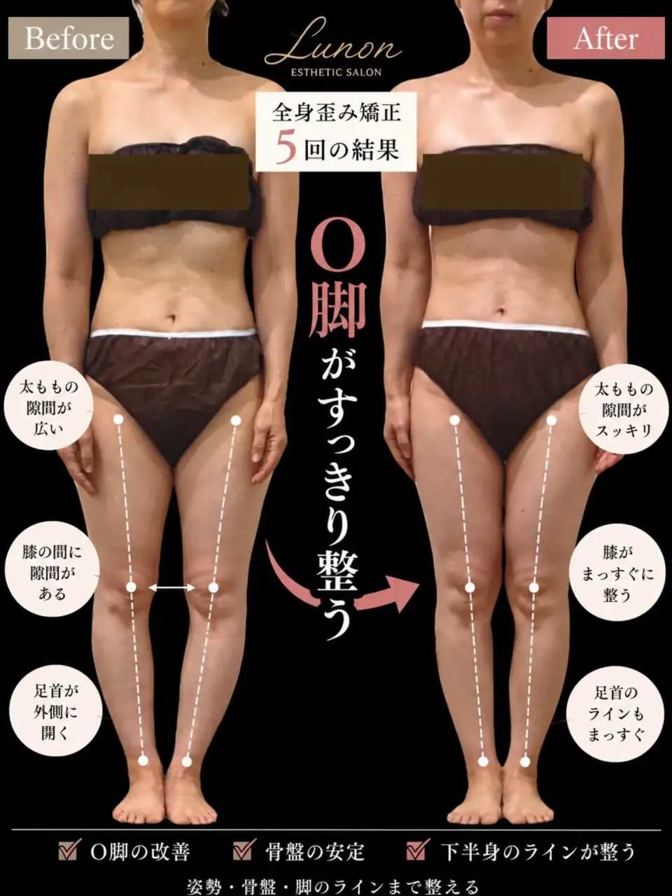 ❁Lunonの全身歪み矯正❁
