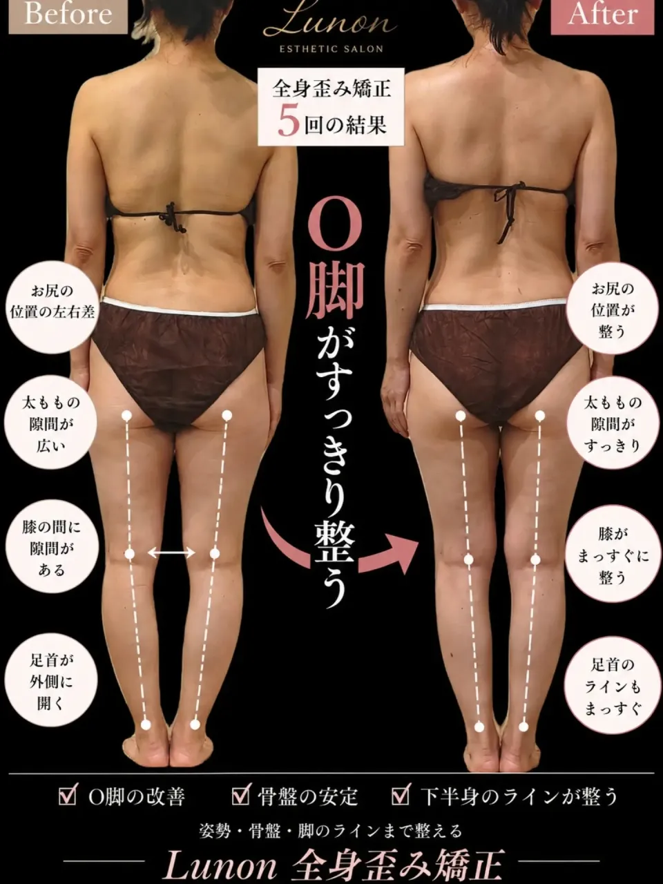 ❁Lunonの全身歪み矯正❁