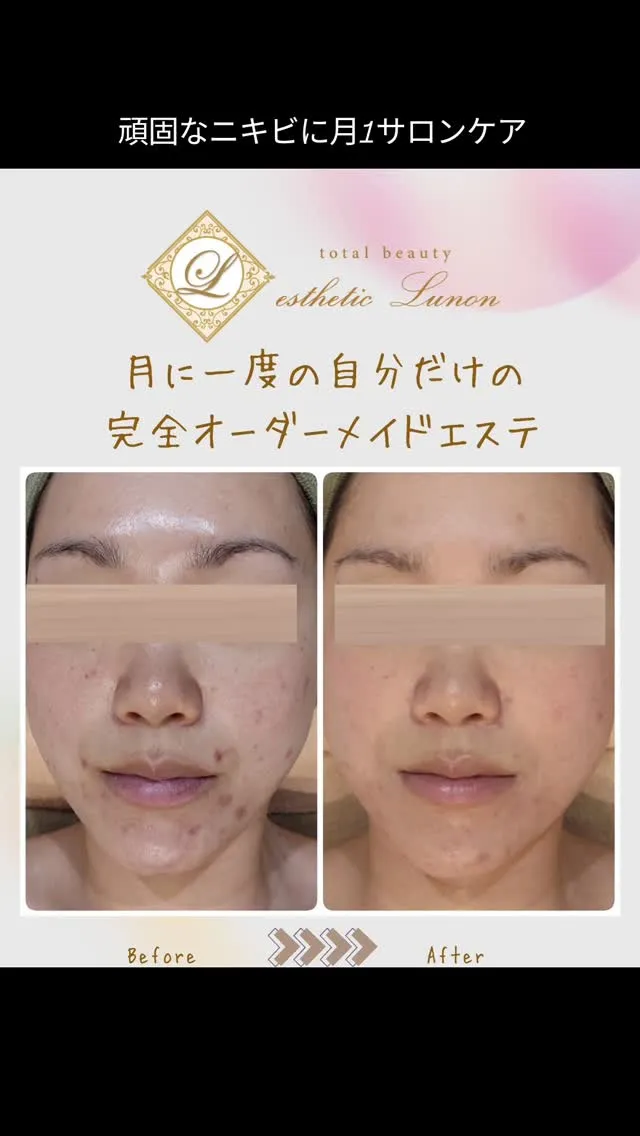大人女性のお悩みに応える〜エステティックLunon〜