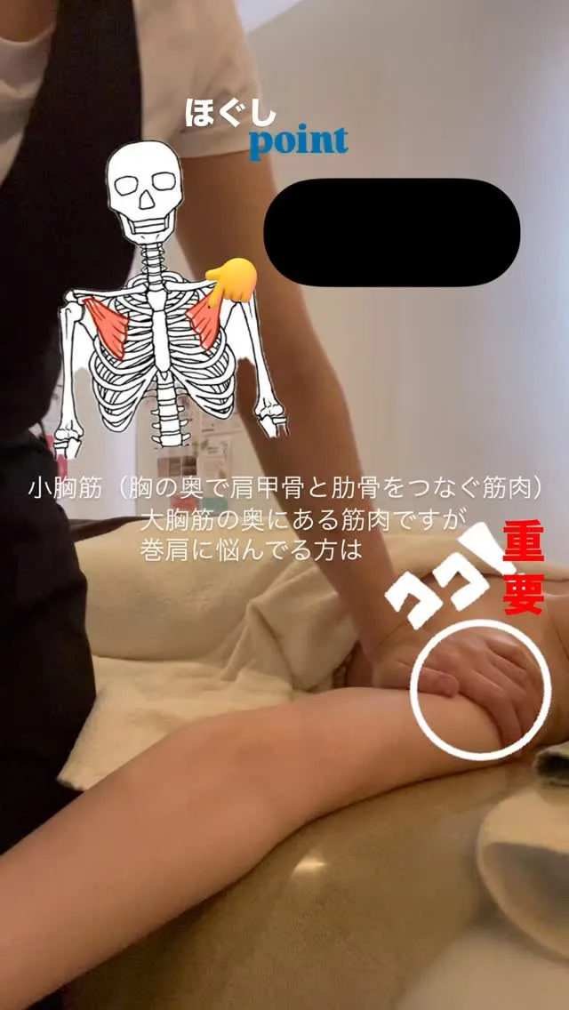 巻肩や肩凝り・猫背にお悩みの方